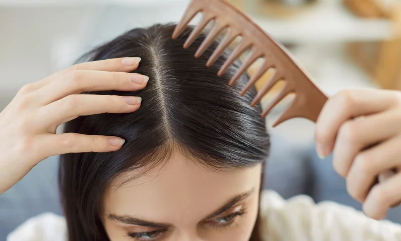 Hair and Scalp Diseases