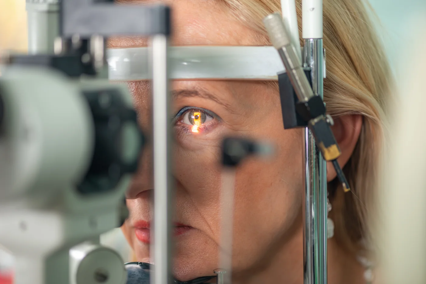 Glaucoma (Intraocular Pressure)