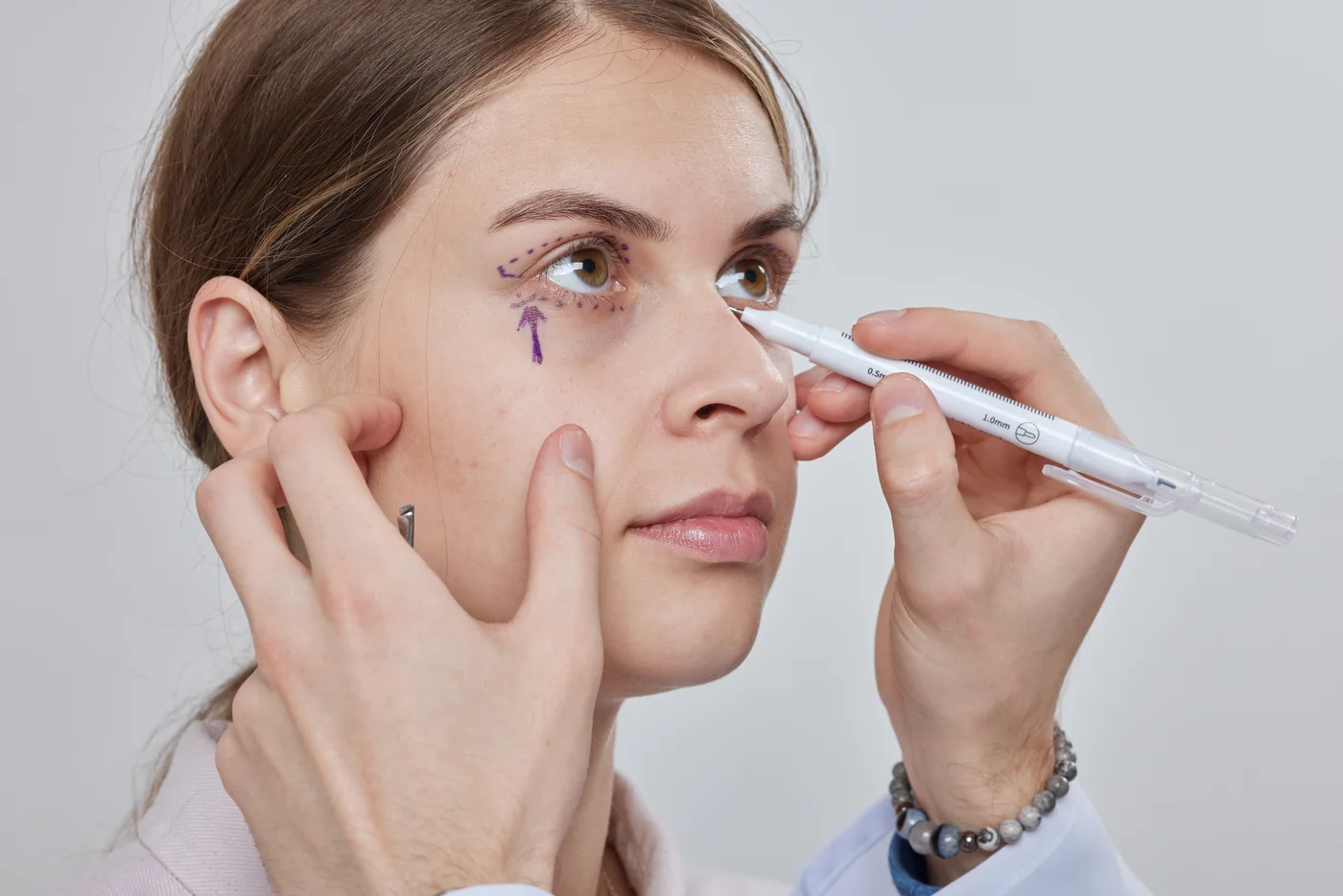 Eyelid Aesthetics (Blepharoplasty)
